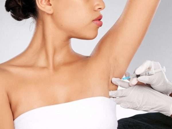 Ботокс или лазер: что лучше для борьбы с потливостью подмышек?
